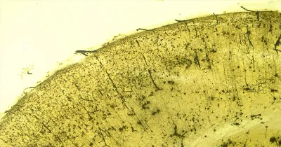Foto zum Beitrag „Pinealon“ (Neuropeptide)