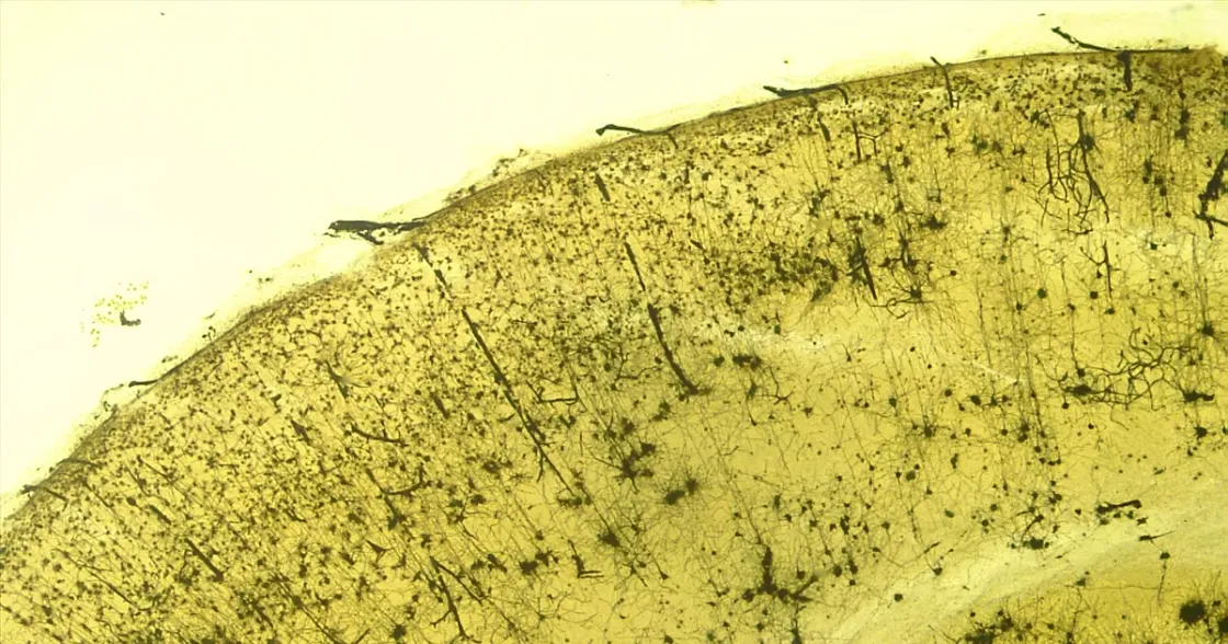 Foto zum Beitrag „Pinealon“ (Neuropeptide)