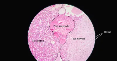 Foto zum Beitrag „GH-Achse im Vergleich: Ipamorelin, CJC-1295 & Tesamorelin“ (GH-Achse & Sekretagoga)