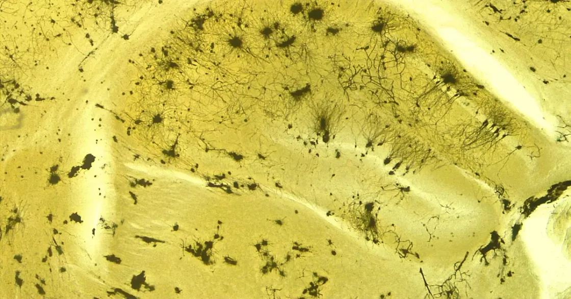 Foto zum Beitrag „Semax vs. Selank“ (Neuropeptide)